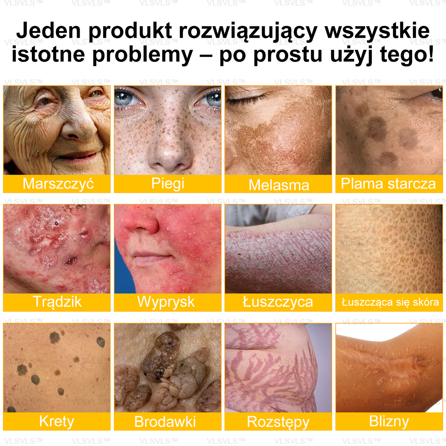 VLSVLS™ Ultimate Krem odbudowujący skórę całego ciała – (🧑‍⚕️ Zalecane przez ekspertów ⏰ Błyskawiczne rezultaty 🤩 Zwycięzca Nagrody Wybór Czytelników 2024)