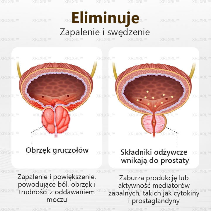 XRLXRL® ProstaVibe Zdrowia Pszczołowego Inhalator