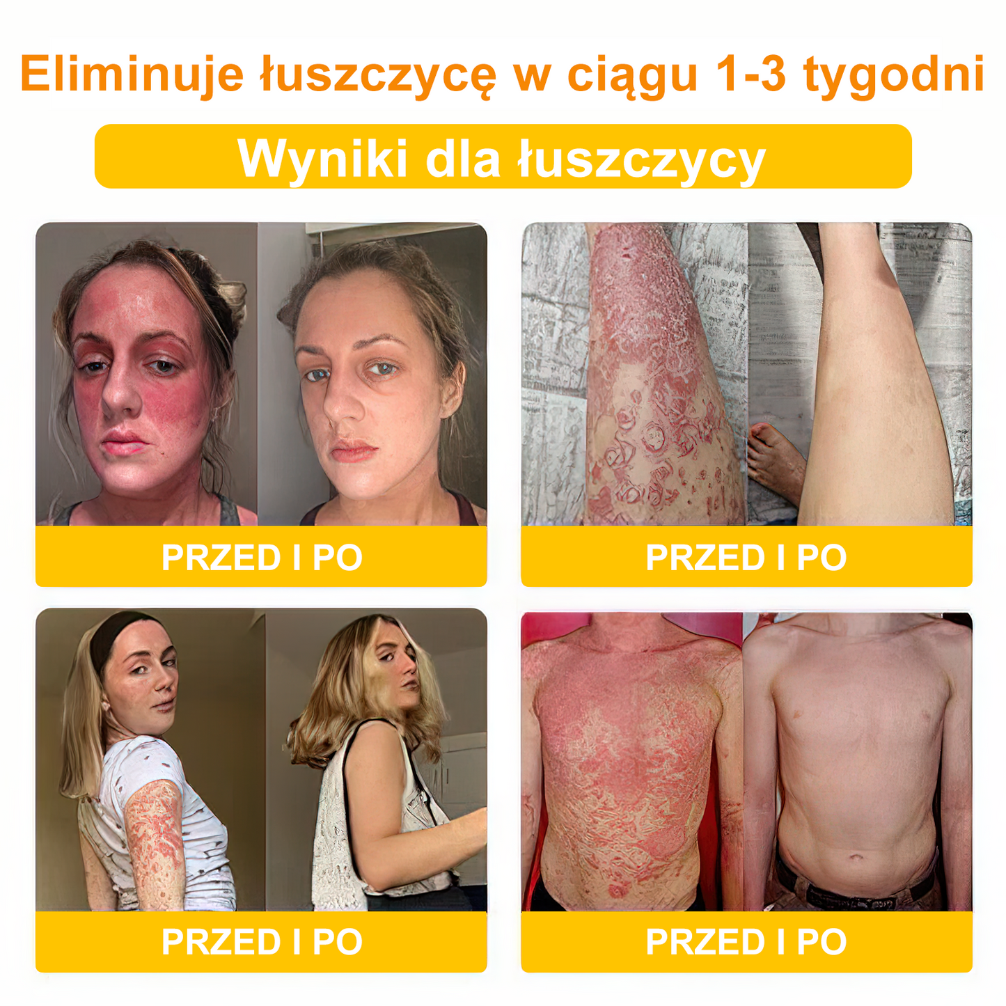 🌼💁 ♀️Krem przeciwbakteryjny do usuwania jadu pszczół Velisse™ Bee Venom – leczy wiele chorób skóry (zalecany ADD)